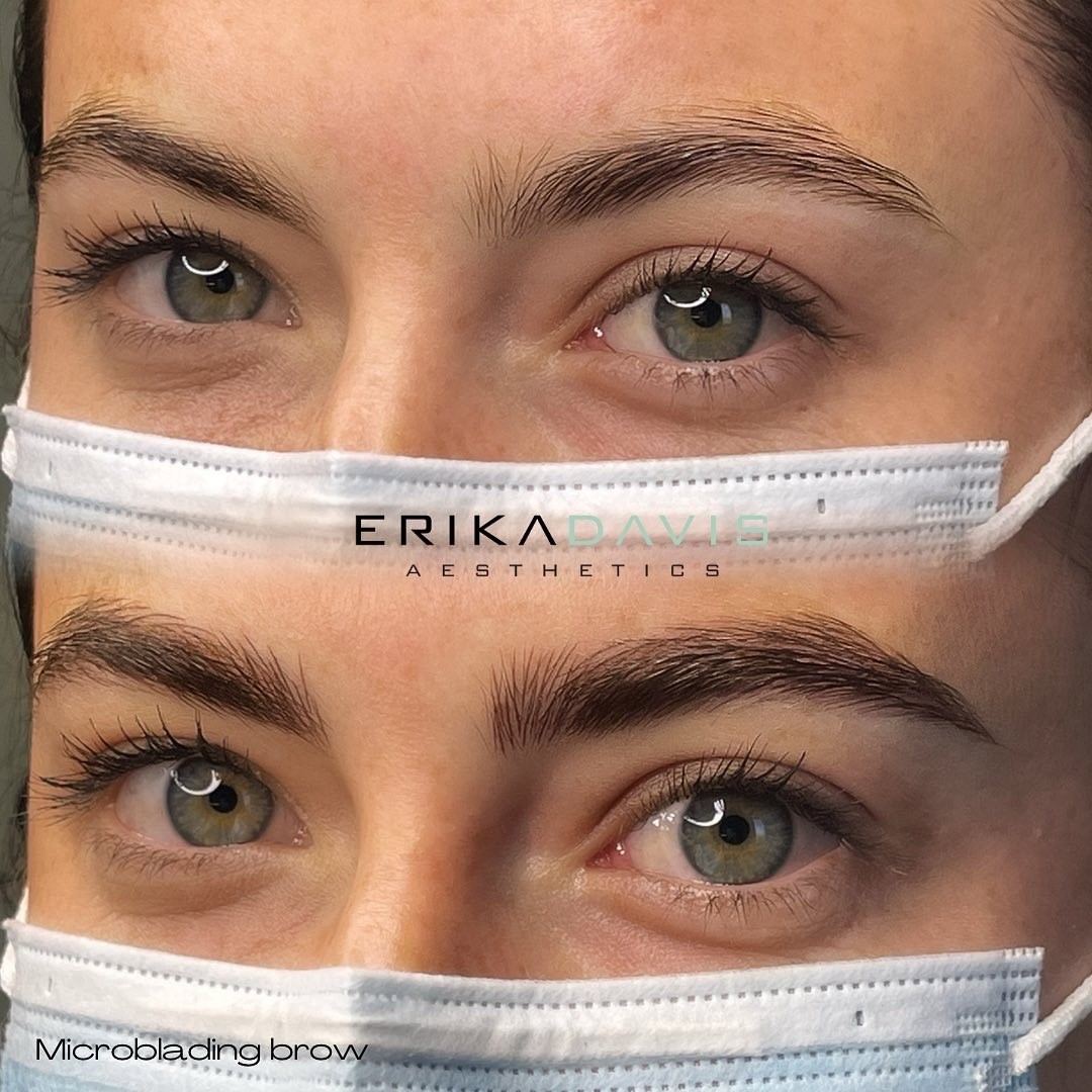 Microblading brow before and after result by Erika Davis Aesthetics