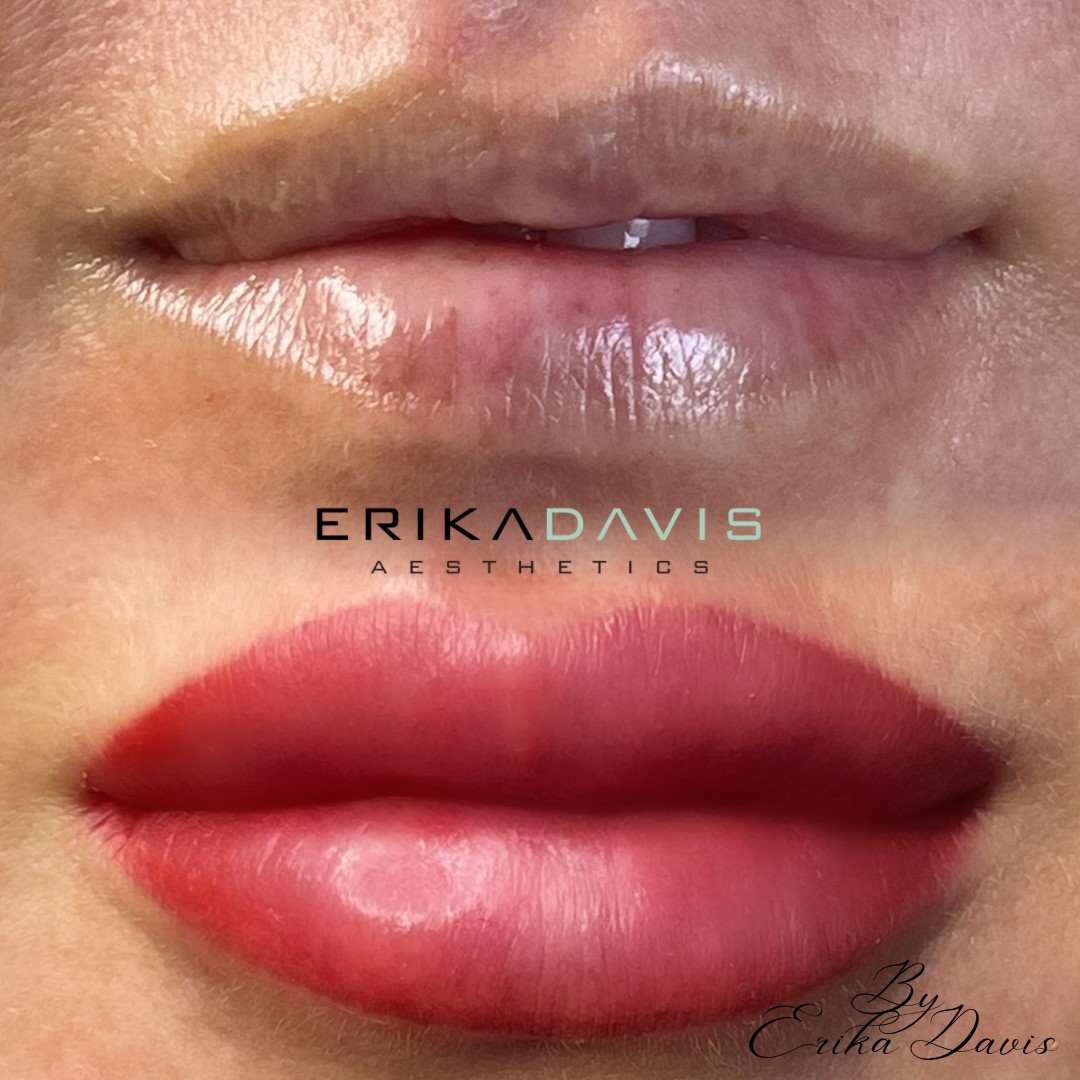 Red lip blush before and after result by Erika Davis Aesthetics
